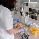 CBC Blood test Price